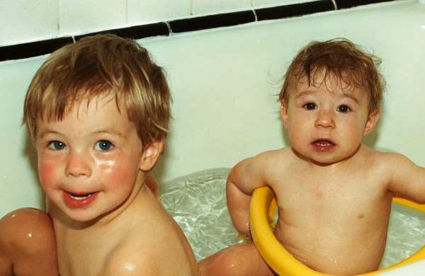 At eleven months, Matt had no scar on his chest.  July 1986